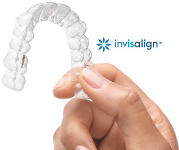 Invisalign Teen: What You Need to Know